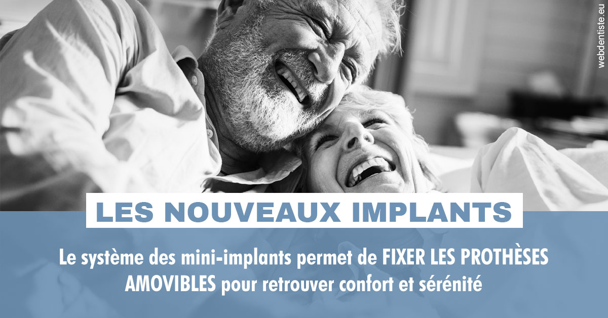 https://dr-carpentier-laurent.chirurgiens-dentistes.fr/Les nouveaux implants 2