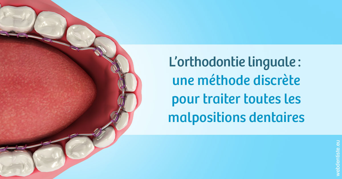 https://dr-carpentier-laurent.chirurgiens-dentistes.fr/L'orthodontie linguale 1