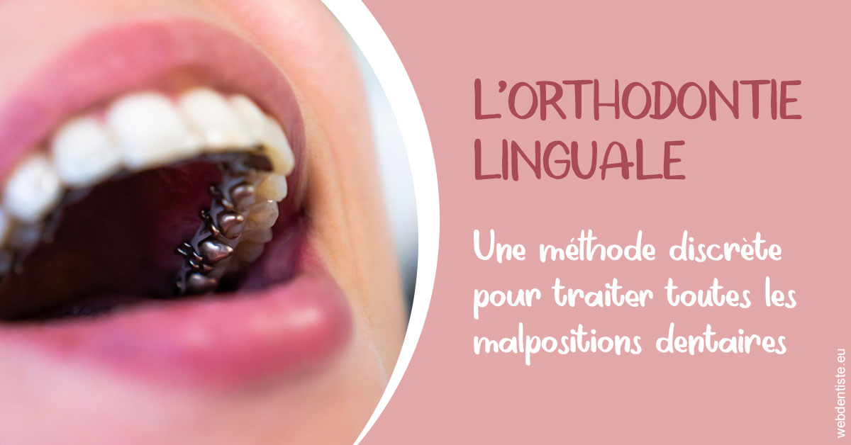 https://dr-carpentier-laurent.chirurgiens-dentistes.fr/L'orthodontie linguale 2