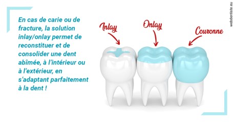 https://dr-carpentier-laurent.chirurgiens-dentistes.fr/L'INLAY ou l'ONLAY