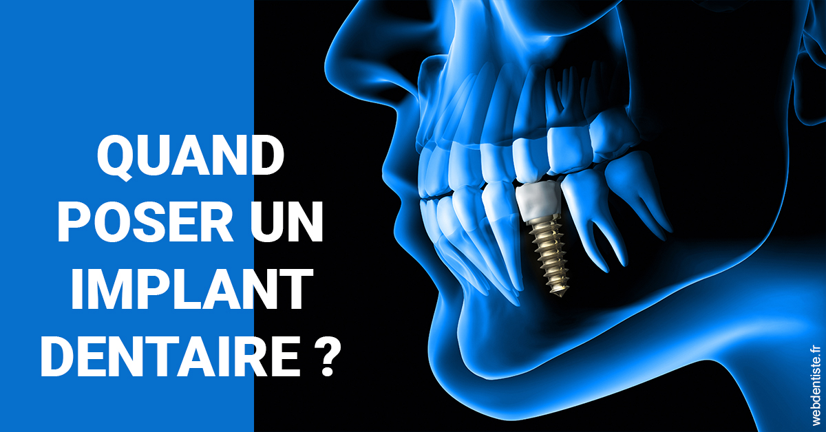 https://dr-carpentier-laurent.chirurgiens-dentistes.fr/Les implants 1