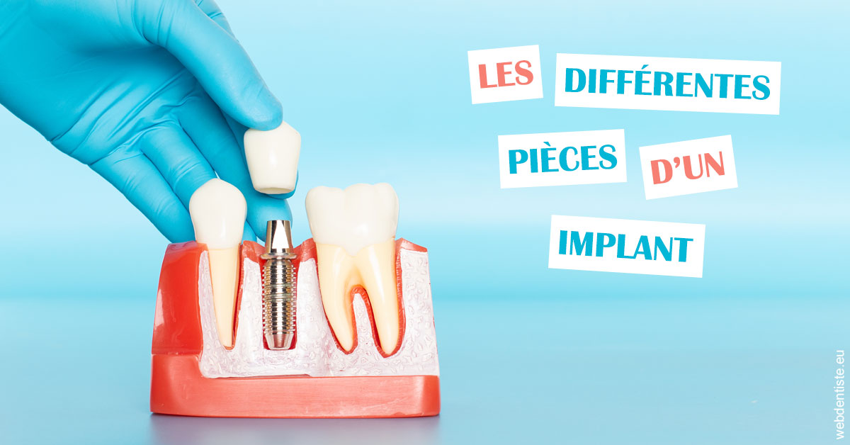 https://dr-carpentier-laurent.chirurgiens-dentistes.fr/Les différentes pièces d’un implant 2