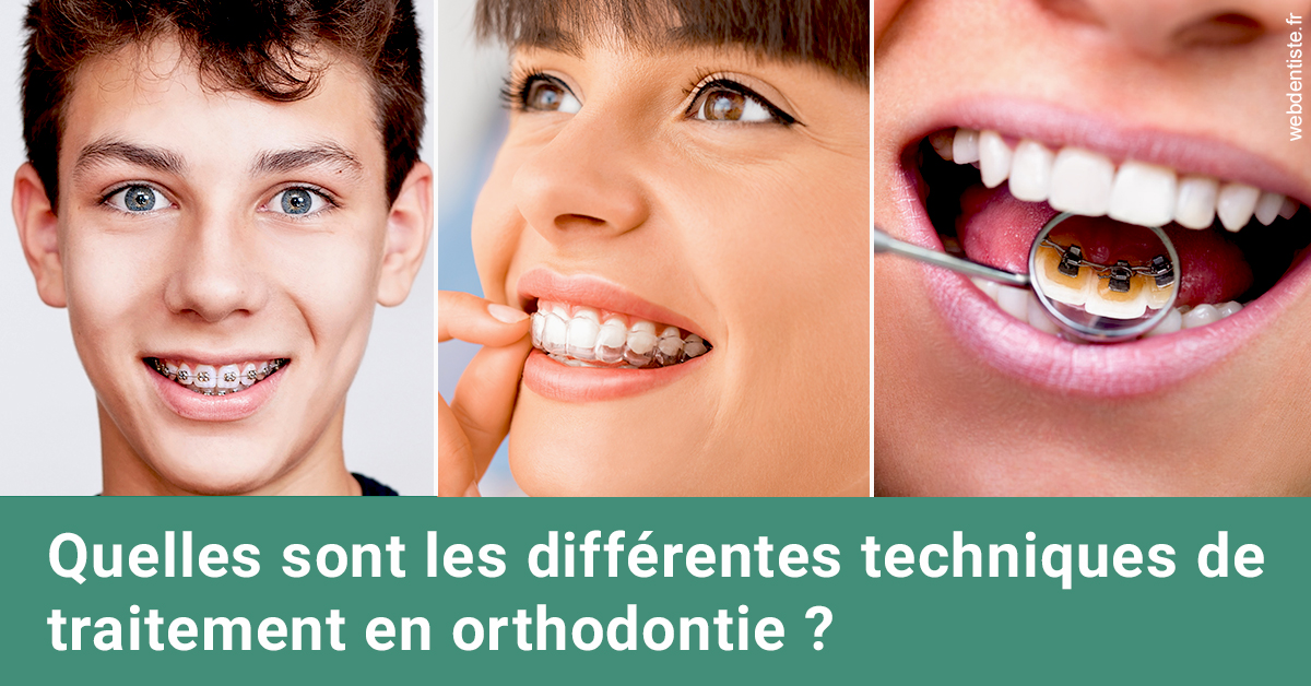 https://dr-carpentier-laurent.chirurgiens-dentistes.fr/Les différentes techniques de traitement 2