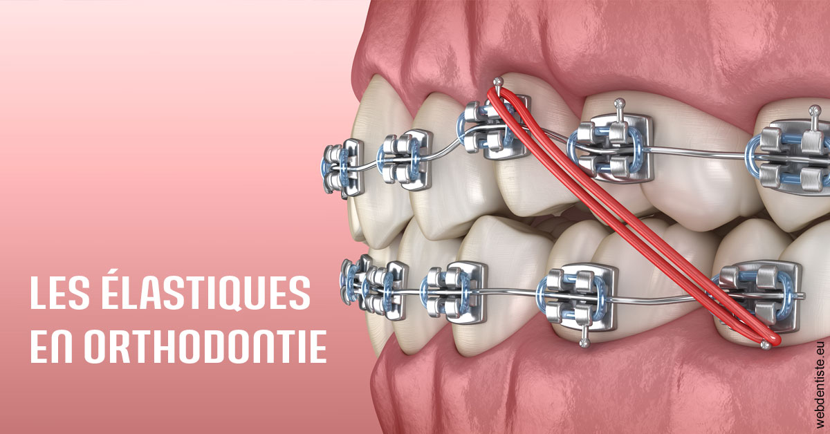 https://dr-carpentier-laurent.chirurgiens-dentistes.fr/Elastiques orthodontie 2