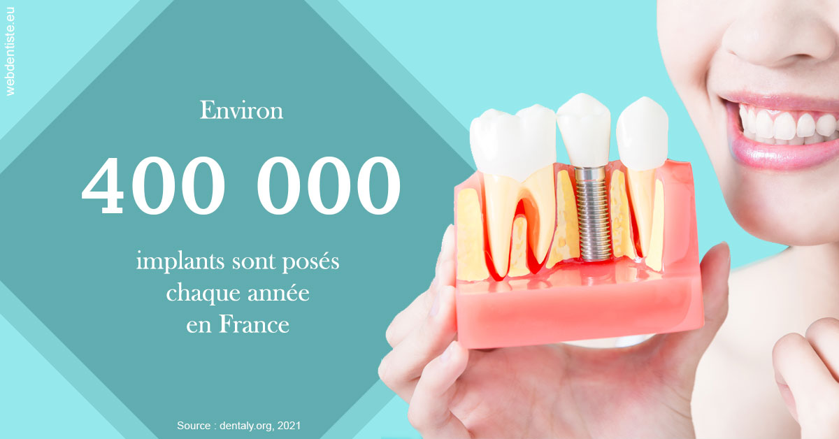https://dr-carpentier-laurent.chirurgiens-dentistes.fr/Pose d'implants en France 2