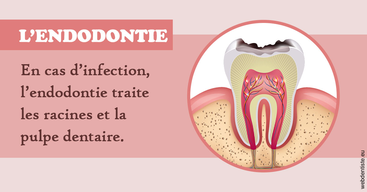 https://dr-carpentier-laurent.chirurgiens-dentistes.fr/L'endodontie 2